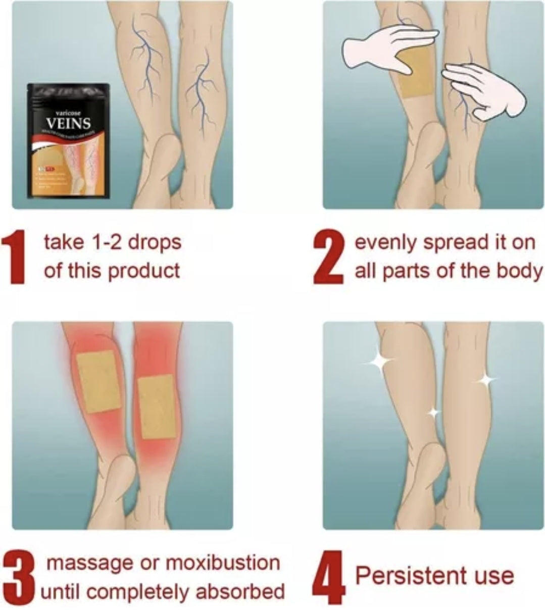 Parche Varices